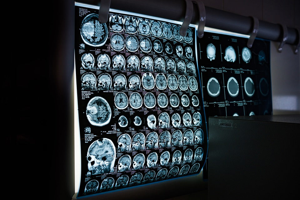 Ahora tenemos las Gafas Medicas para Radiologia